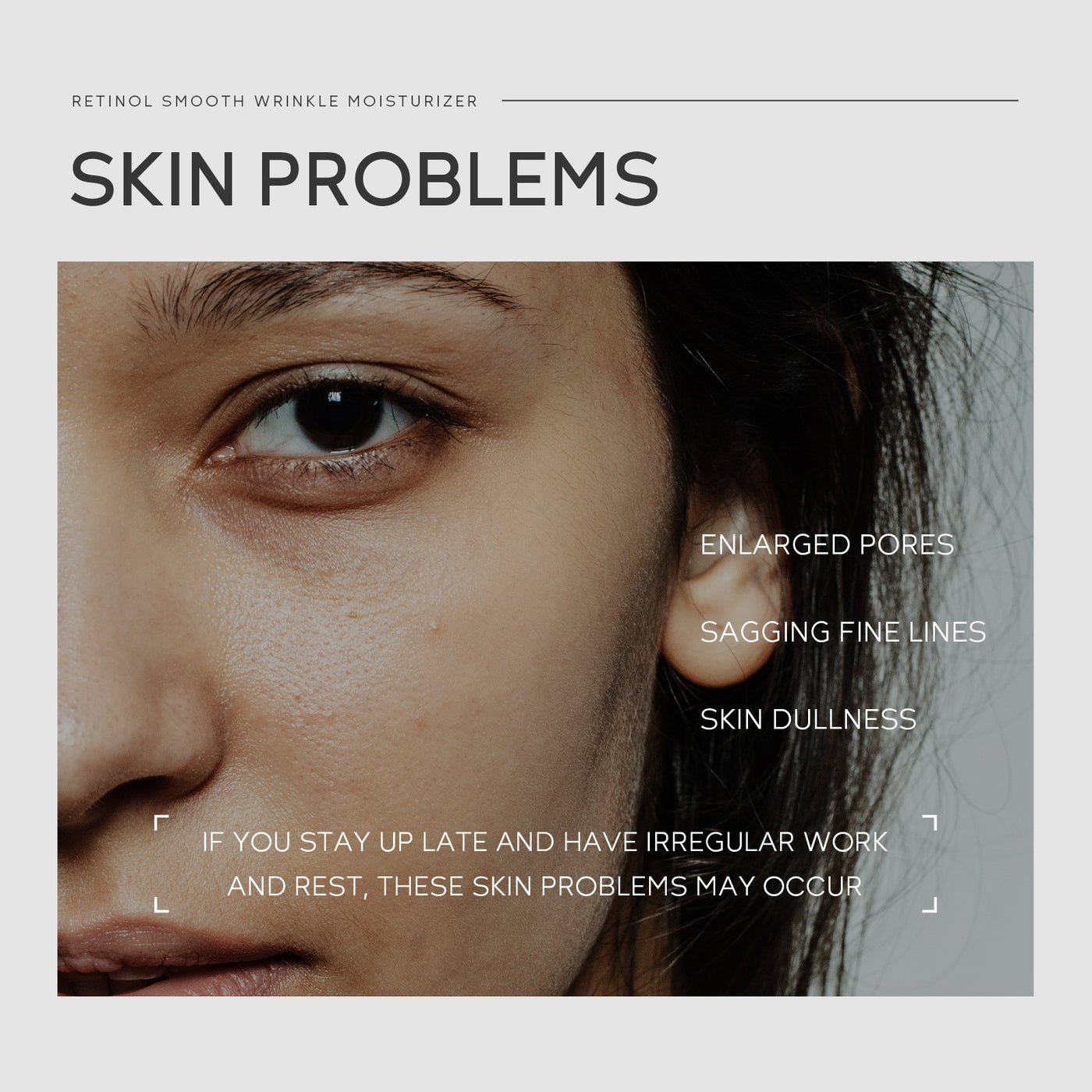 Retinol Cream 30g Moisturizing Repair